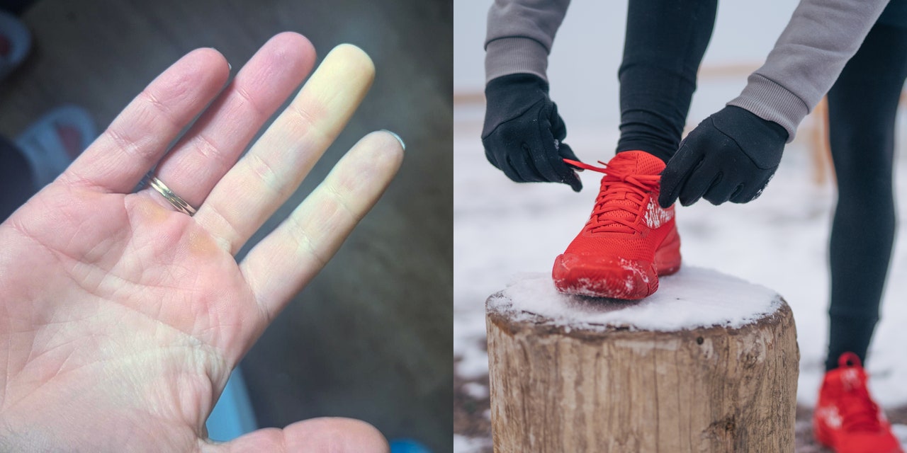 how-to-exercise-outside-with-raynaud’s-syndrome-without-freezing-your-fingers-off